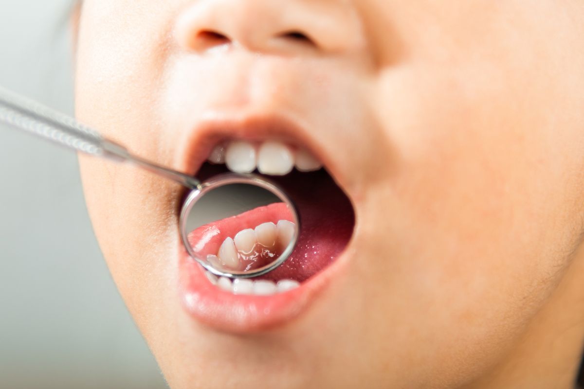 Dentista para niños en Reinosa, Clínica Dental Mayor 4