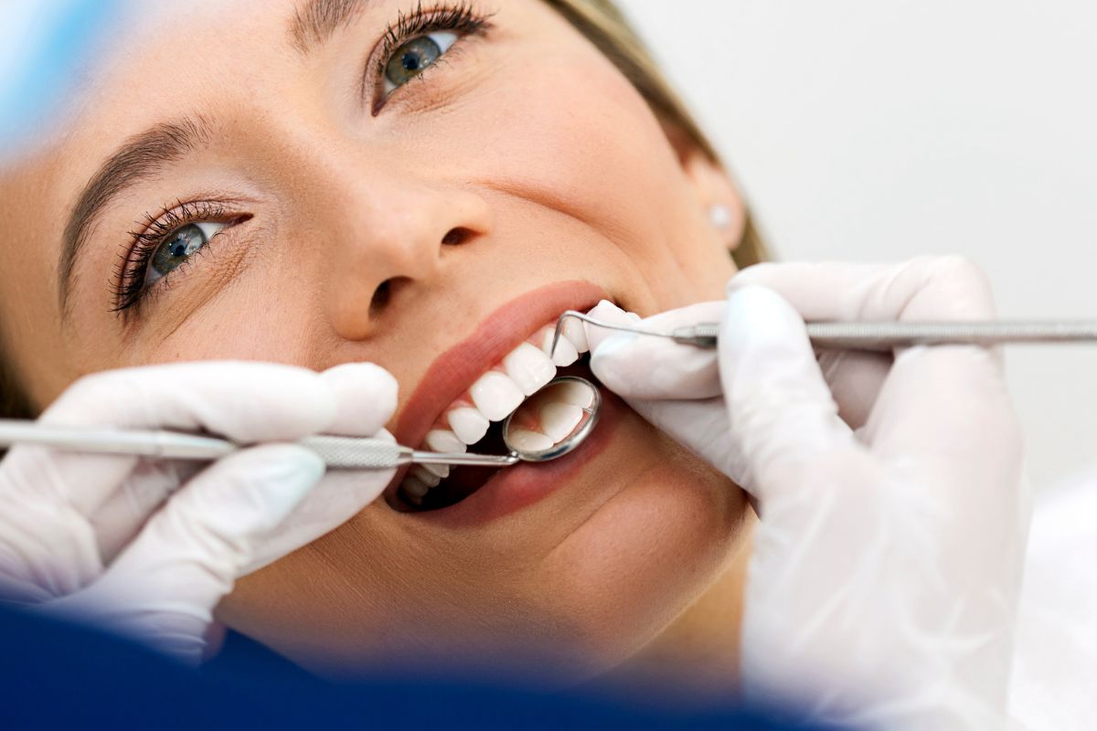 Lee más sobre el artículo Limpieza dental en Reinosa